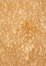 Image of skin (50X magnification) (pigmented spot)